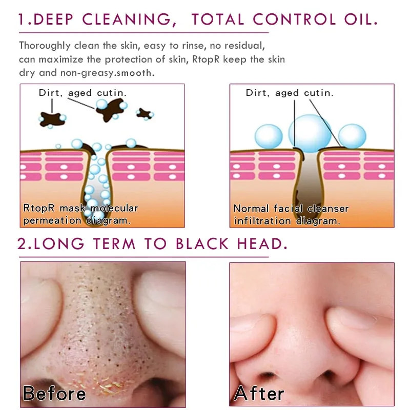 Blackhead Remover Acne Treatment Nose Oil-control Mud Mask